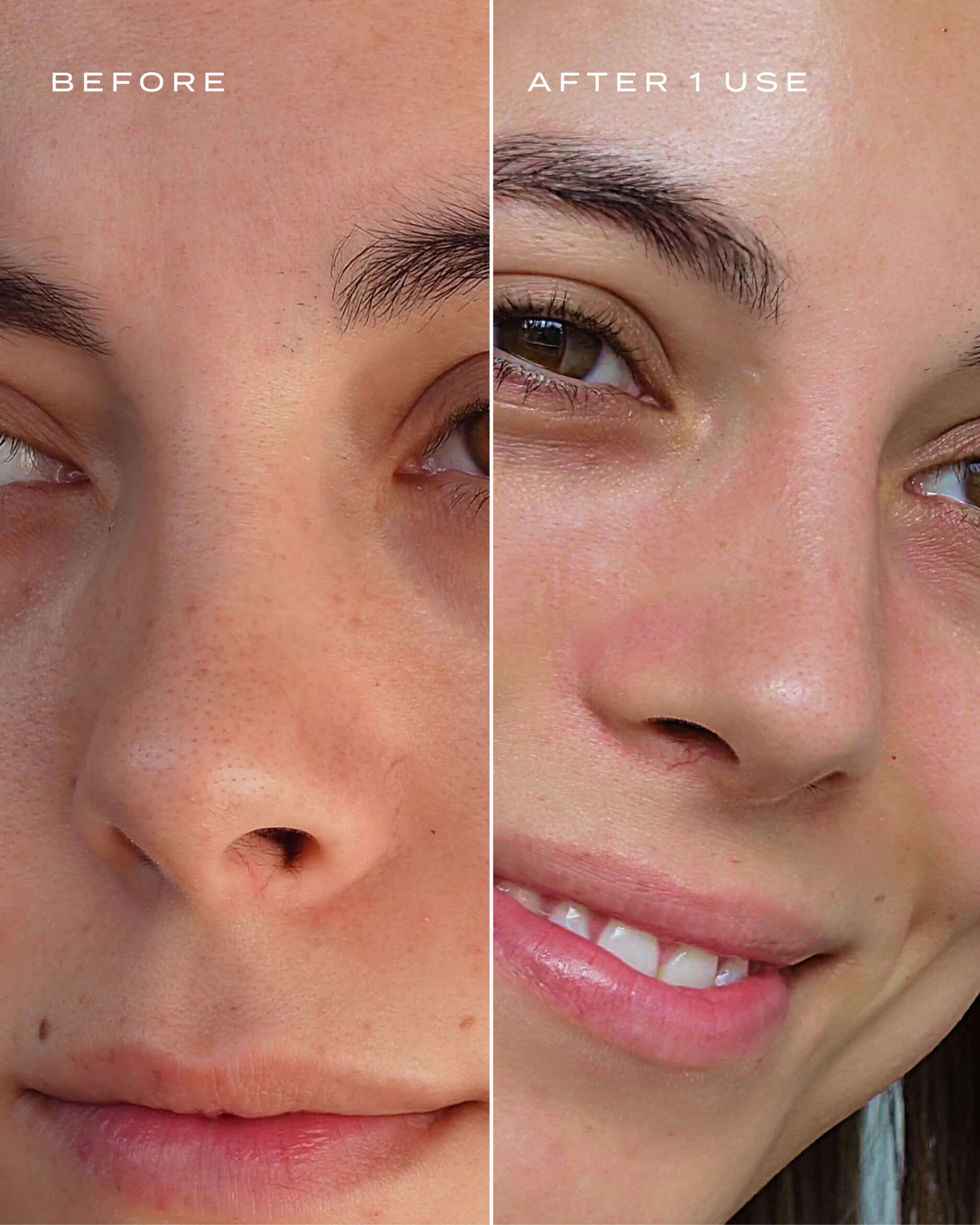 Magic Nose Pore Cleansers